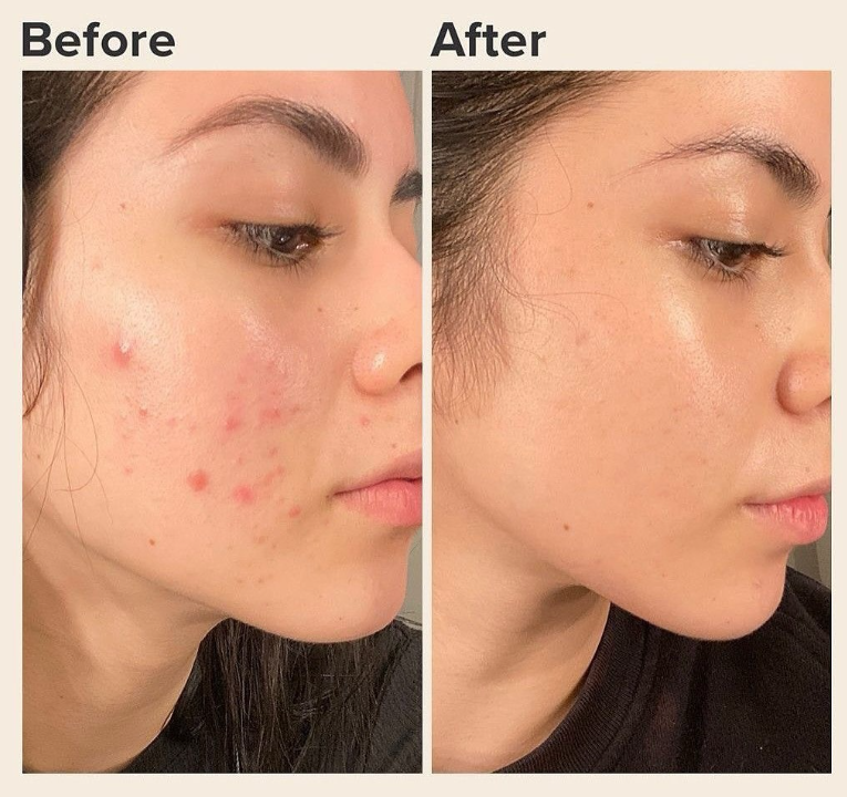 Cilt Bakımı Çalışması